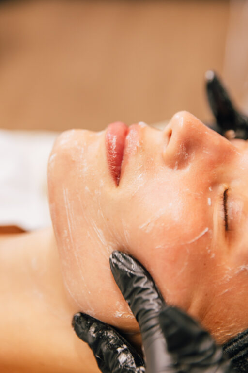 A close-up image of a patient receiving a chemical peel near Lenexa. The peel is being applied to her face as she relaxes, eyes closed, during her treatment.